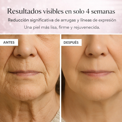 Suero Facial Microinfusion GLOV