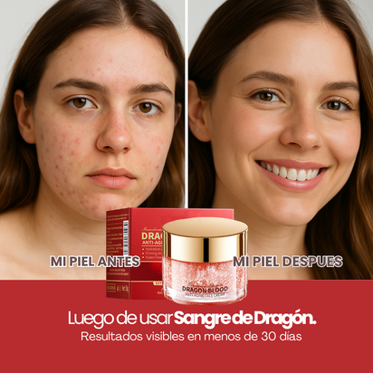 Pack Sangre de Dragón Serum + Crema