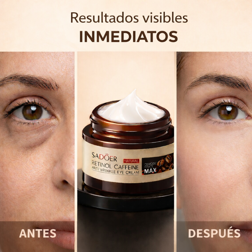 Contorno de Ojos con Cafeína y Retinol – Desinflama y Revitaliza